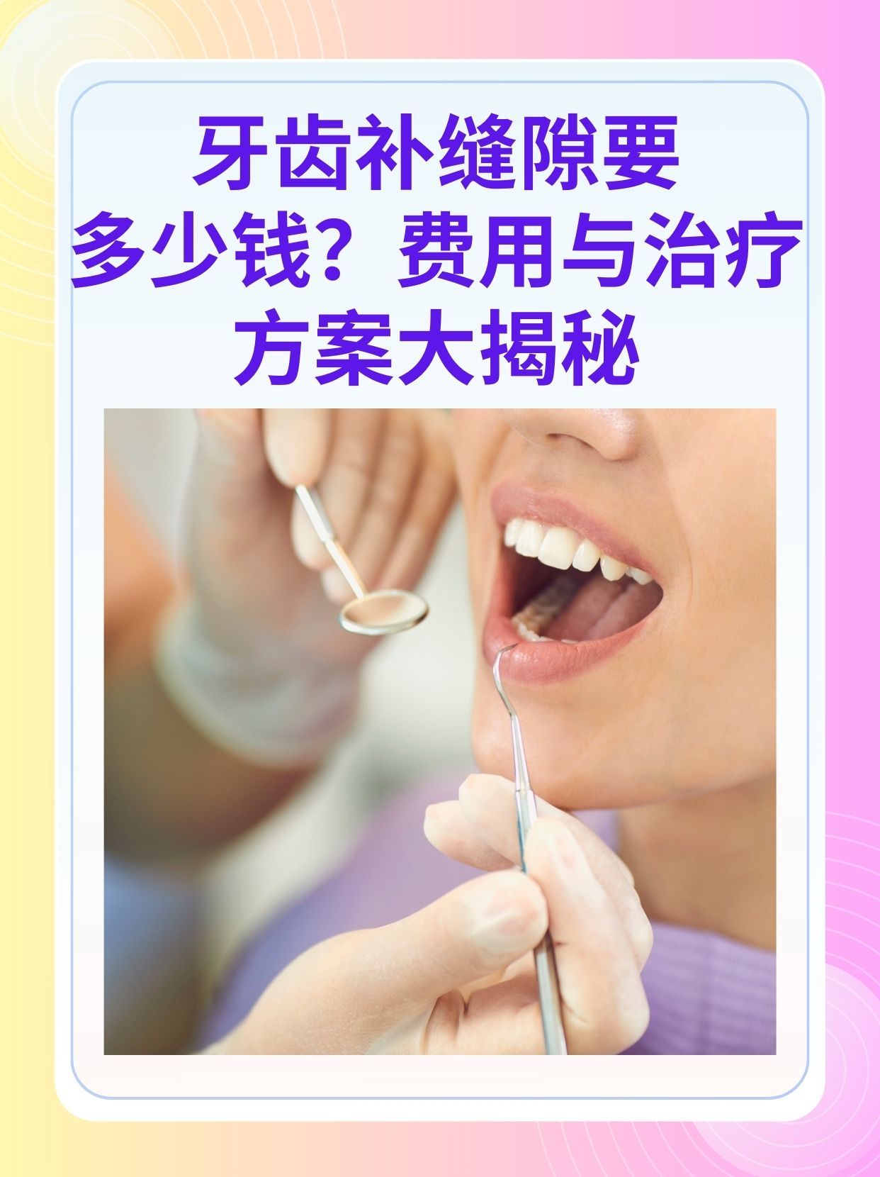 遵义补牙医保可以报销吗(补牙医保可以报销吗 哪些可以报销呢)